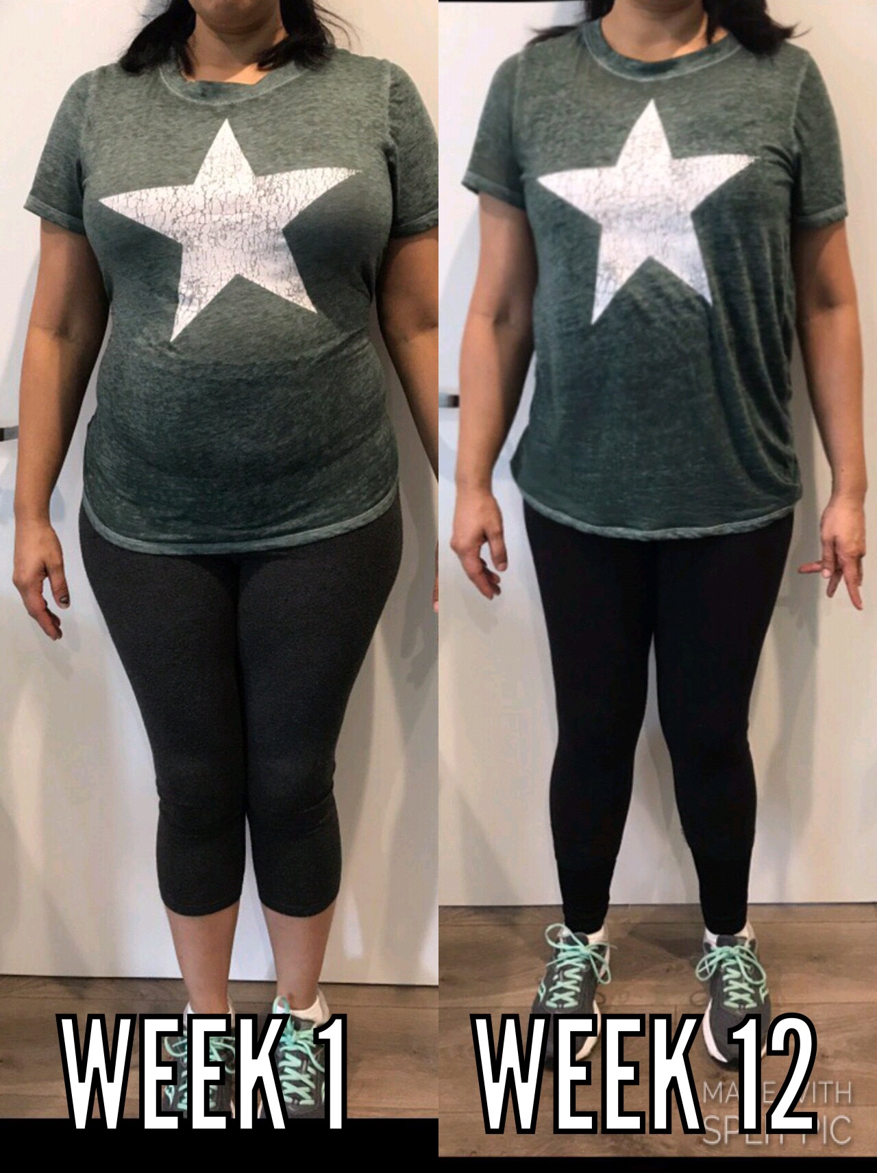 MBX Before and After Weight Loss Story 1
